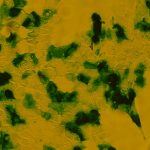 lacZ (Neo) lentiviral particles - Image 2