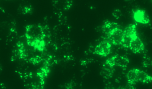 GFP labelled Peroxisome