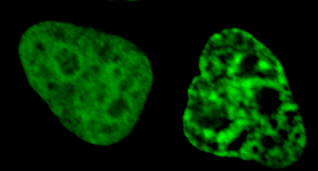 Live Visualization of Chromatin