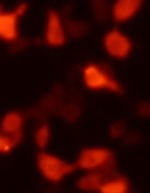 RFP-2a-Puromycin (EF1a Promoter),  Concentrated Lentivirus - Image 2