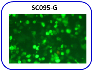 Human PC-9 cell line / GFP image
